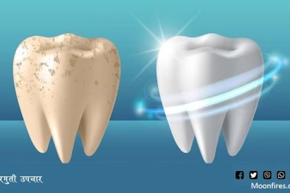 घरगुती उपचार पिवळ्या दातांना पांढऱ्या मोत्यांसारखे चमकवा